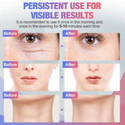 EMS Neck & Face Beauty Device - Microcurrent & Light Therapy for Wrinkle Reduction & Skin Rejuvenation