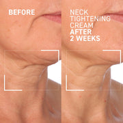 Dr. Brandt Needles No More Neck Tightening Cream, Firming and Hydrating, 1.7 oz, 2672939