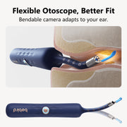 Bebird Earwax Removal Kit with 1080P HD Camera, Wireless Wi-Fi, Flexible Ultra-Slim Tube, Multiple Silicone Tips, Blue, D39R
