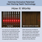 Hairmax LaserBand 82 ComfortFlex Hair Regrowth Device with 82 Medical-Grade Lasers, Flexible Band, Rechargeable Battery, 9.6 oz, 1030016