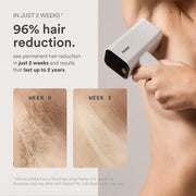 Nood Flasher Pro IPL Laser Hair Removal Device with Sapphire Cooling, Dual-Action Hair Removal and Anti-Aging Lenses, Gloss White, T16A