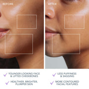 Foreo Bear 2 Go Microcurrent Facial Device, Travel-Friendly, Anti Aging, Face Sculpting, Instant Full Face Lift, Firming and Contouring, Lavender, F1825
