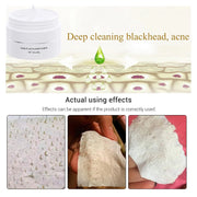 Hiroke 1170402 Blackhead Remover Peel Off Mask for Face and Nose, Deep Cleansing Pore Strips, 1.05oz