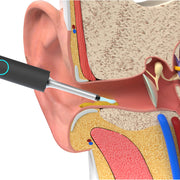Bebird W3 Ear Cleaning Otoscope System