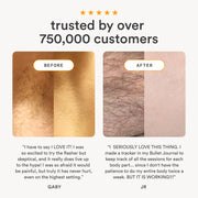 Nood Flasher 2.0 IPL Laser Hair Removal Device, Pain-Free Permanent Results, Matte Black, Corded KCA423