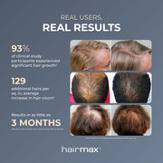 Hairmax LaserBand 82 ComfortFlex Hair Regrowth Device with 82 Medical-Grade Lasers, Flexible Band, Rechargeable Battery, 9.6 oz, 1030016