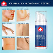 Slitz Scar Gel Silicone Scar Reducing Treatment Gel, 1.06 oz