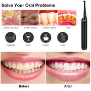 Laixi 104139 Electric Dental Calculus Remover Ultrasonic Portable Teeth Cleaner with 3 Cleaning Heads Rechargeable Oral Care Kit