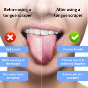 JTF Sonic Electric Toothbrush for Adults and Kids, 5 Brushing Modes, 8 Brush Heads, Tongue Scraper, Travel Bag, Rechargeable, Purple