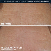 RoC Retinol Correxion Deep Wrinkle Rich Cream, Patented Retinol, Bio-Ceramides, Calcium, Fragrance-Free, Paraben-Free, 1.7 oz
