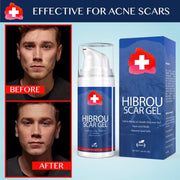 Slitz Scar Gel Silicone Scar Reducing Treatment Gel, 1.06 oz