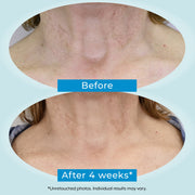 Plexaderm Dual Action Repair Cream, 1% Retinol, 2% Bakuchiol, Hyaluronic Acid, Anti Aging Facial Moisturizer, 1 fl oz