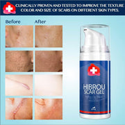 Slitz Scar Gel Silicone Scar Reducing Treatment Gel, 1.06 oz