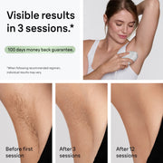 Braun PL1103 IPL Silk-Expert Mini Laser Hair Removal at Home, Permanent Hair Reduction for Women and Men
