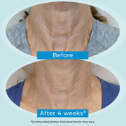 Plexaderm Dual Action Repair Cream, 1% Retinol, 2% Bakuchiol, Hyaluronic Acid, Anti Aging Facial Moisturizer, 1 fl oz