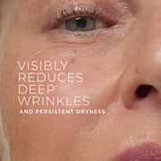 RoC Retinol Correxion Deep Wrinkle Rich Cream, Patented Retinol, Bio-Ceramides, Calcium, Fragrance-Free, Paraben-Free, 1.7 oz