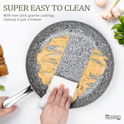 Michelangelo Stone Cookware Set, 10 Piece, Ultra Nonstick Granite Coating, Aluminum Pots and Pans, Oven Safe to 400F, Induction Compatible