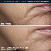 RoC Retinol Correxion Deep Wrinkle Rich Cream, Patented Retinol, Bio-Ceramides, Calcium, Fragrance-Free, Paraben-Free, 1.7 oz