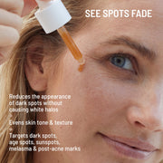 Dr. Brandt Dark Spots No More Triple Acid Spot Minimizing Concentrate Gel, 0.5 oz