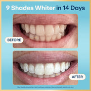 Lumineux Enamel Safe Teeth Whitening Strips, Peroxide-Free, Dentist Formulated, 7 Treatments, Comfortable Fit