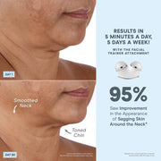 NuFACE Trinity Starter Kit Microcurrent Facial Device with Gel Activator, Silk Crme, Brush, Portable Handheld Design