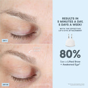 NuFACE Trinity Starter Kit Microcurrent Facial Device with Gel Activator, Silk Crme, Brush, Portable Handheld Design