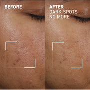 Dr. Brandt Dark Spots No More Triple Acid Spot Minimizing Concentrate Gel, 0.5 oz